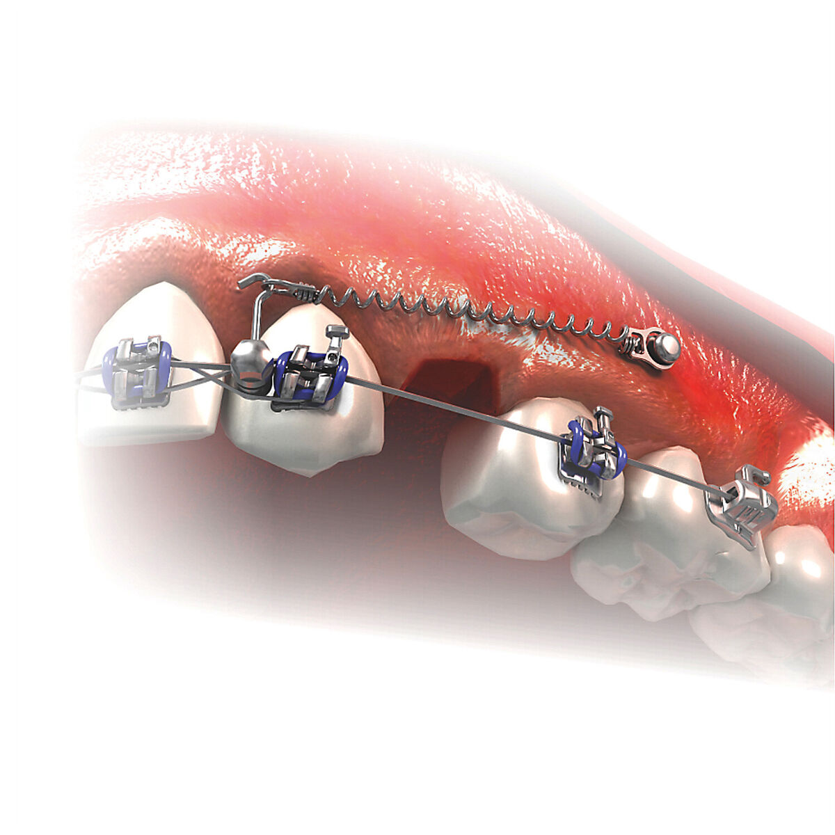 Výsledky naší léčby