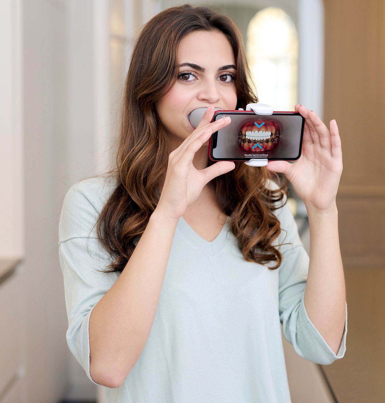 DentalMonitoring